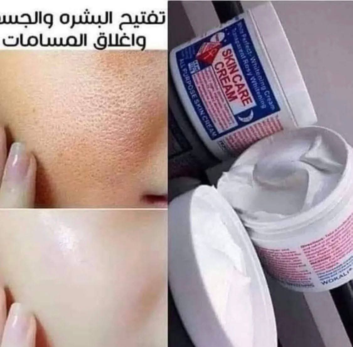 كريم العناية بالبشرة وايت بيرفكت للتبييض 3
